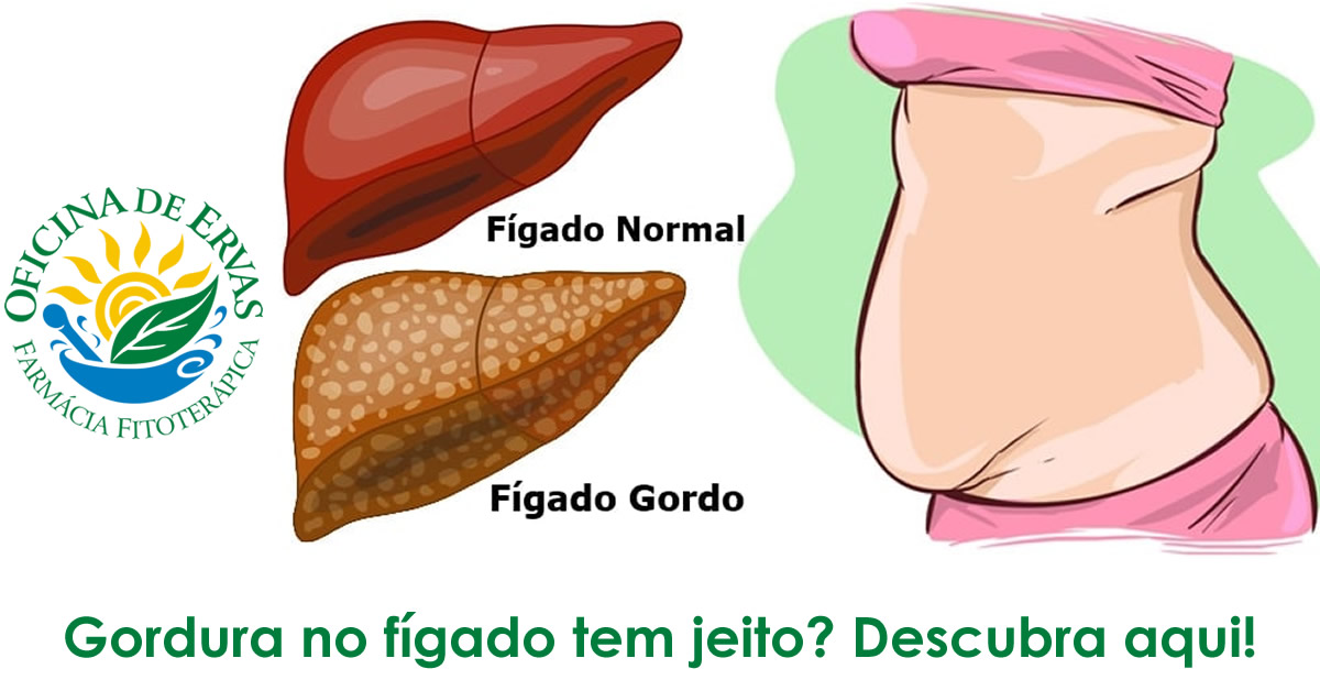 Gordura No F Gado Tem Jeito Descubra Aqui