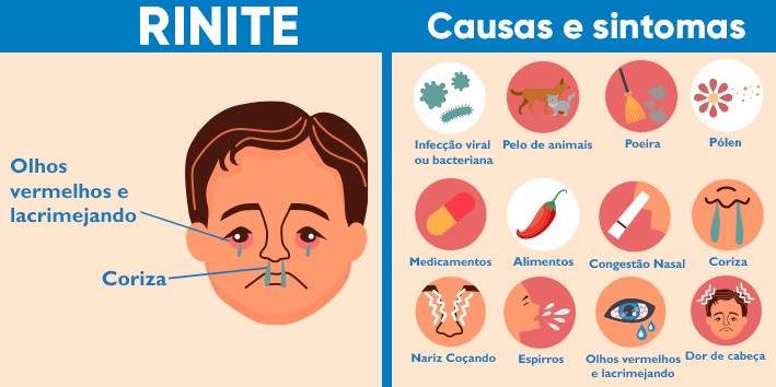 A rinite atacou? Entenda os sintomas e como a fitoterapia pode ajudar!